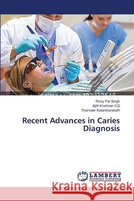 Recent Advances in Caries Diagnosis Singh Ricky Pal                          Cg Ajith Krishnan                        Kalantharakath Thanveer 9783659570766