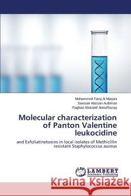 Molecular characterization of Panton Valentine leukocidine Faraj Al Marjani Mohammed 9783659577758 LAP Lambert Academic Publishing