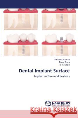 Dental Implant Surface Raman Shrimant                           Arora Pooja                              Singh S. P. 9783659594328