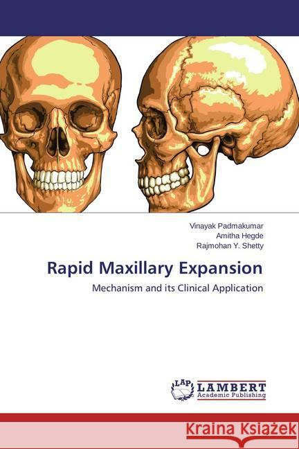 Rapid Maxillary Expansion : Mechanism and its Clinical Application Padmakumar, Vinayak; Hegde, Amitha; Shetty, Rajmohan Y. 9783659612022