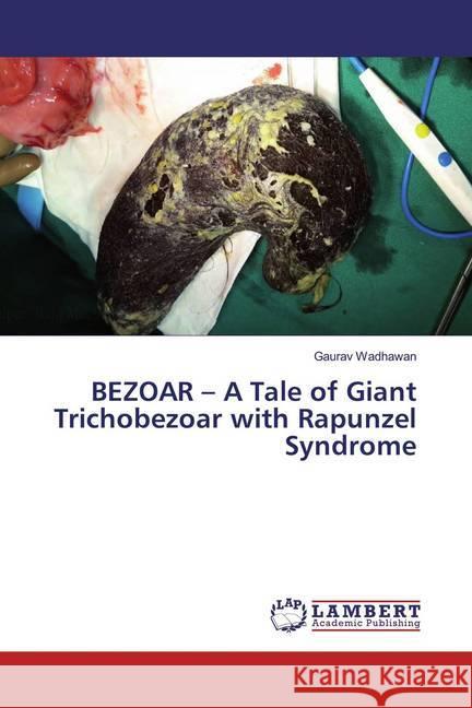 BEZOAR - A Tale of Giant Trichobezoar with Rapunzel Syndrome Wadhawan, Gaurav 9783659622373