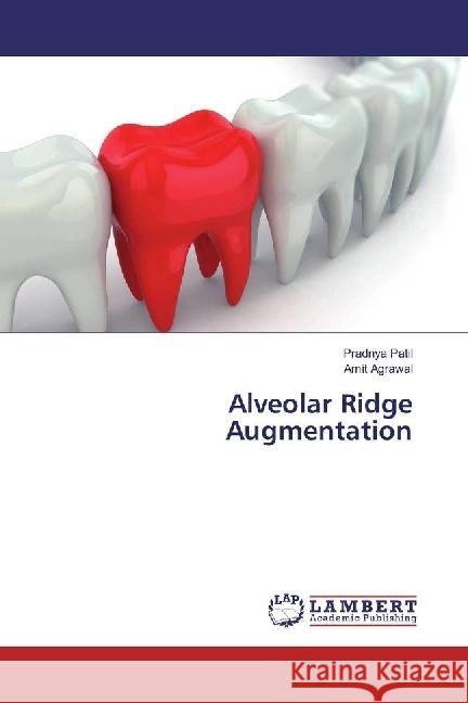 Alveolar Ridge Augmentation Patil, Pradnya; Agrawal, Amit 9783659637674 LAP Lambert Academic Publishing