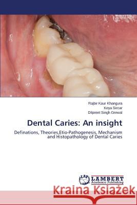 Dental Caries: An insight Khangura Rajbir Kaur 9783659637933