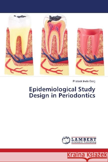 Epidemiological Study Design in Periodontics Garg, Prateek Irwin 9783659644689