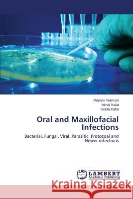 Oral and Maxillofacial Infections Vermani Mayank 9783659675683 LAP Lambert Academic Publishing