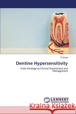 Dentine Hypersensitivity Suma R. 9783659684869 LAP Lambert Academic Publishing