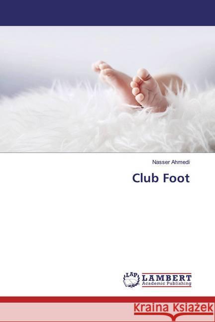 Club Foot Ahmedi, Nasser 9783659685149 LAP Lambert Academic Publishing