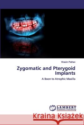 Zygomatic and Pterygoid Implants Wasim Pathan 9783659695292