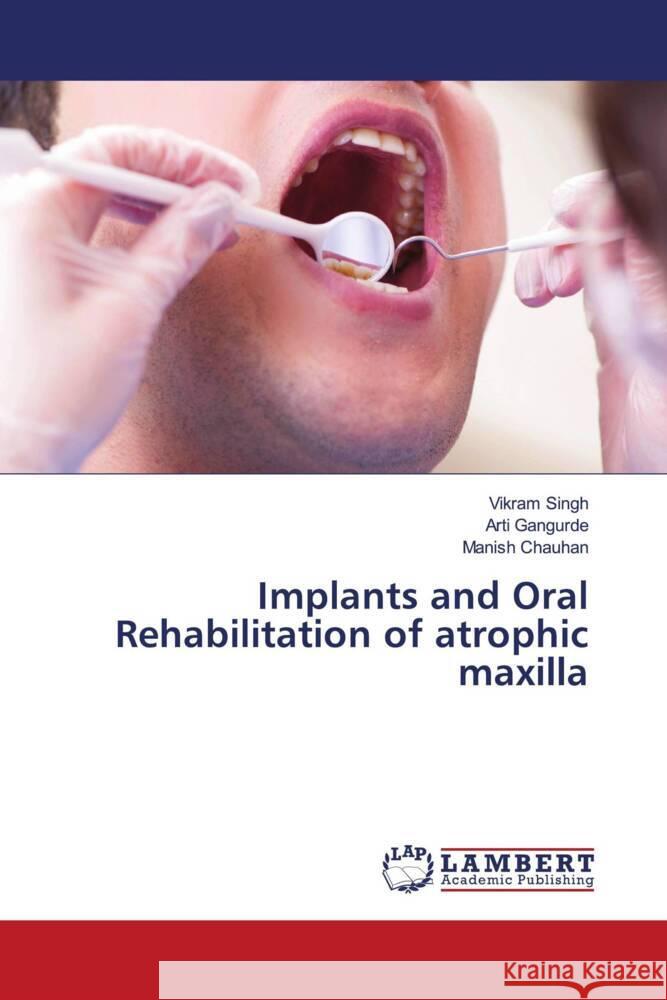 Implants and Oral Rehabilitation of atrophic maxilla Singh, Vikram, Gangurde, Arti, Chauhan, Manish 9783659707711 LAP Lambert Academic Publishing