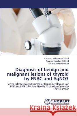 Diagnosis of benign and malignant lesions of thyroid by FNAC and AgNO3 Mohammed Abdul Rasheed 9783659717147 LAP Lambert Academic Publishing