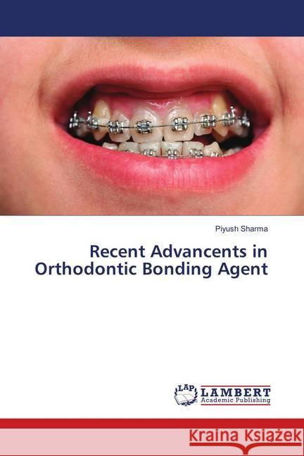 Recent Advancents in Orthodontic Bonding Agent Sharma, Piyush 9783659742514