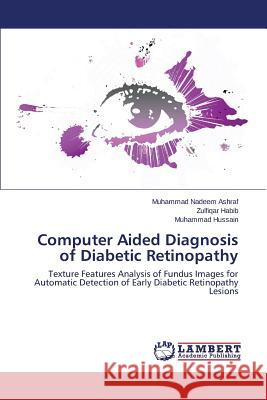 Computer Aided Diagnosis of Diabetic Retinopathy Nadeem Ashraf Muhammad 9783659772092 LAP Lambert Academic Publishing