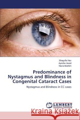 Predominance of Nystagmus and Blindness in Congenital Cataract Cases Naz Shagufta 9783659789274 LAP Lambert Academic Publishing