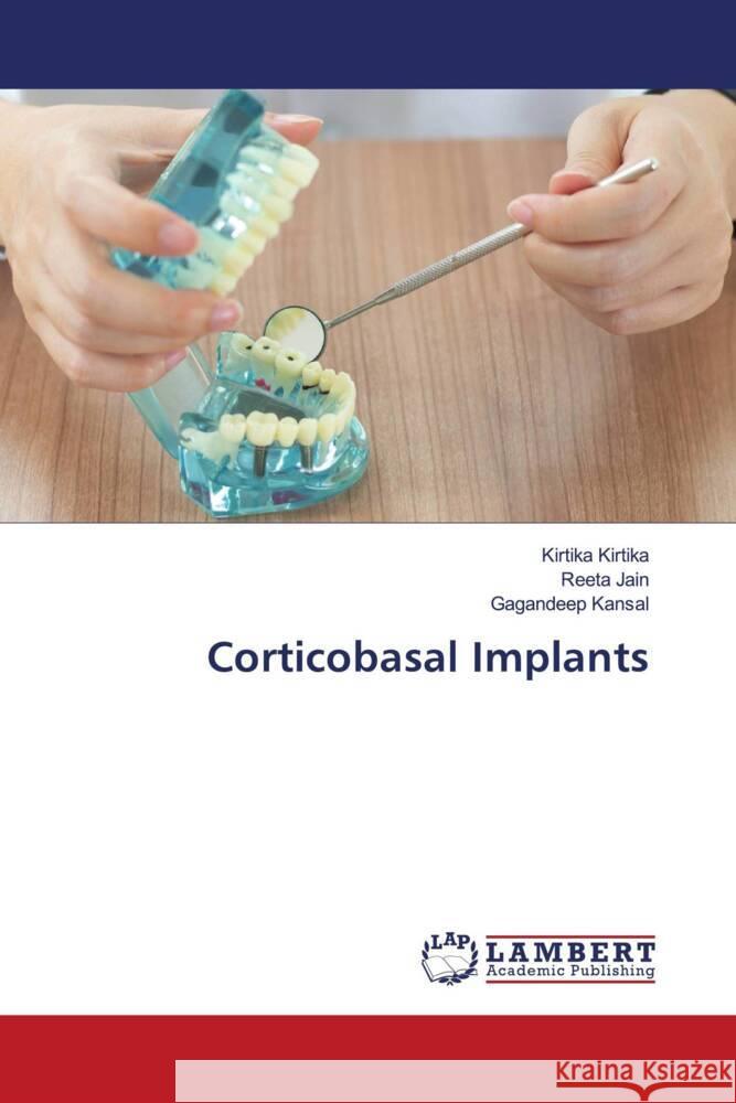 Corticobasal Implants Kirtika, Kirtika, Jain, Reeta, Kansal, Gagandeep 9783659802669