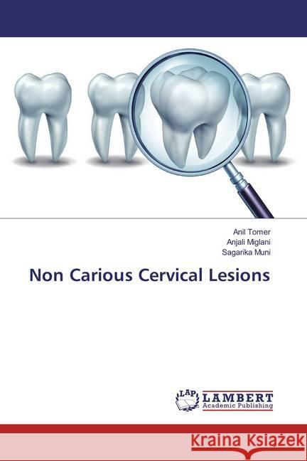 Non Carious Cervical Lesions Tomer, Anil; Miglani, Anjali; Muni, Sagarika 9783659802881 LAP Lambert Academic Publishing