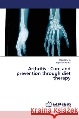 Arthritis: Cure and prevention through diet therapy Shukla Rajni 9783659810442