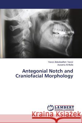 Antegonial Notch and Craniofacial Morphology Abdulkadhim Yassir Yassir 9783659813009 LAP Lambert Academic Publishing