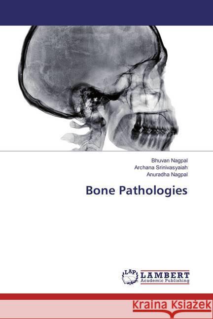 Bone Pathologies Nagpal, Bhuvan; Srinivasyaiah, Archana; Nagpal, Anuradha 9783659864346