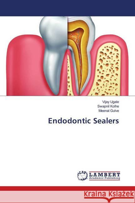 Endodontic Sealers Ugale, Vijay; Kolhe, Swapnil; Gulve, Meenal 9783659865282 LAP Lambert Academic Publishing