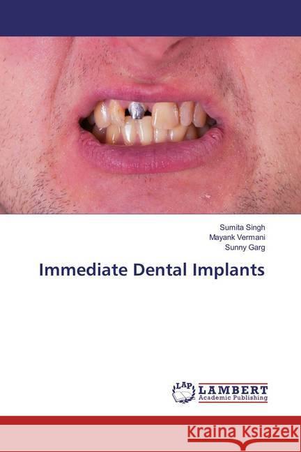 Immediate Dental Implants Singh, Sumita; Vermani, Mayank; Garg, Sunny 9783659879203