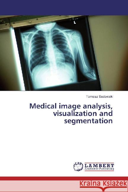 Medical image analysis, visualization and segmentation Sadowski, Tomasz 9783659882654 LAP Lambert Academic Publishing