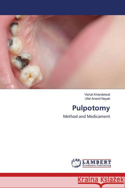 Pulpotomy : Method and Medicament Khandelwal, Vishal; Nayak, Ullal Anand 9783659887222