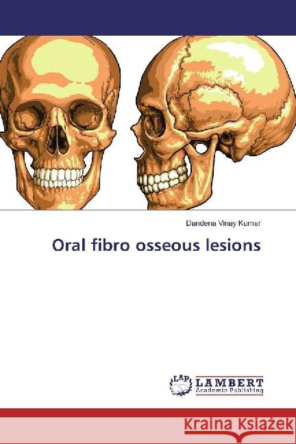 Oral fibro osseous lesions Vinay Kumar, Dandena 9783659906824 LAP Lambert Academic Publishing