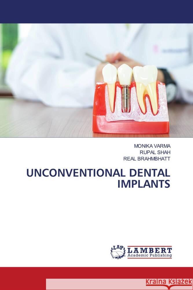 UNCONVENTIONAL DENTAL IMPLANTS VARMA, MONIKA, Shah, Rupal, BRAHMBHATT, REAL 9783659912788