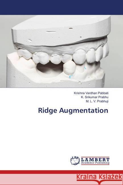 Ridge Augmentation Pabbati, Krishna Vardhan; Prabhu, K. Srikumar; Prabhuji, M. L. V. 9783659917714 LAP Lambert Academic Publishing