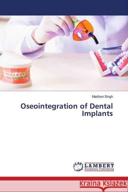 Oseointegration of Dental Implants Singh, Madhavi 9783659937965