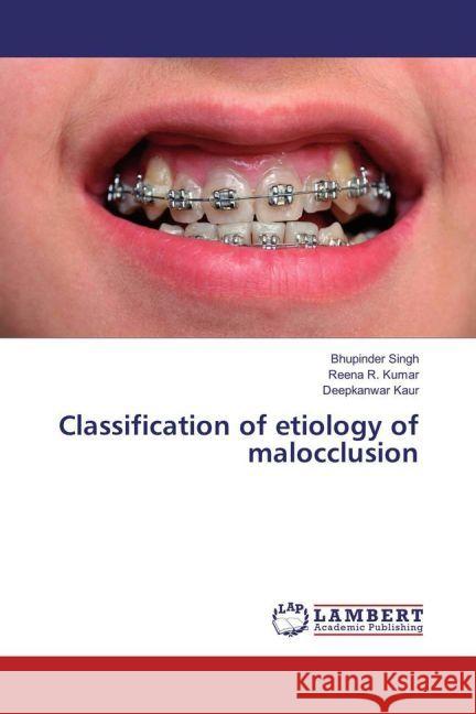 Classification of etiology of malocclusion Singh, Bhupinder; Kumar, Reena R.; Kaur, Deepkanwar 9783659946127 LAP Lambert Academic Publishing