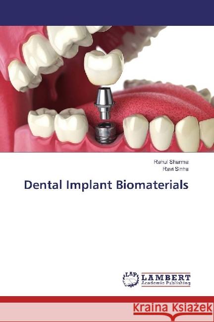 Dental Implant Biomaterials Sharma, Rahul; Sinha, Ravi 9783659957598