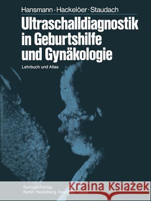 Ultraschalldiagnostik in Geburtshilfe Und Gynäkologie: Lehrbuch Und Atlas Cox, D. N. 9783662005811 Springer