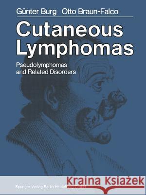 Cutaneous Lymphomas, Pseudolymphomas, and Related Disorders G. Burg M. H. Leider O. Braun-Falco 9783662008904 Springer