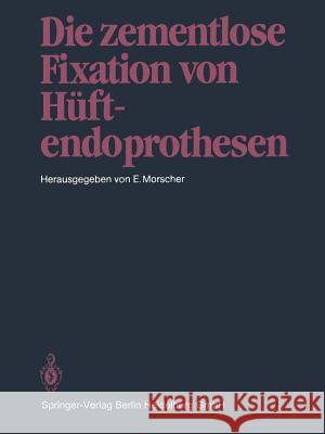 Die Zementlose Fixation Von Hüftendoprothesen Morscher, E. 9783662009680 Springer