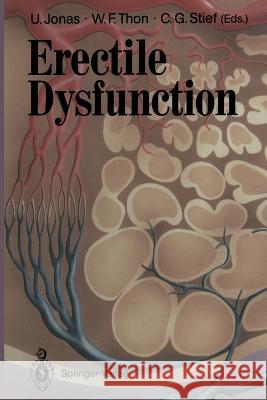Erectile Dysfunction Udo Jonas Walter F. Thon Christian G. Stief 9783662009888 Springer