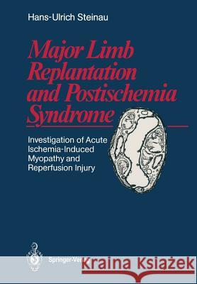 Major Limb Replantation and Postischemia Syndrome: Investigation of Acute Ischemia-Induced Myopathy and Reperfusion Injury Hans-Ulrich Steinau, E. Biemer, A. Encke, Susan Moore-Heidecke 9783662024829 Springer-Verlag Berlin and Heidelberg GmbH & 