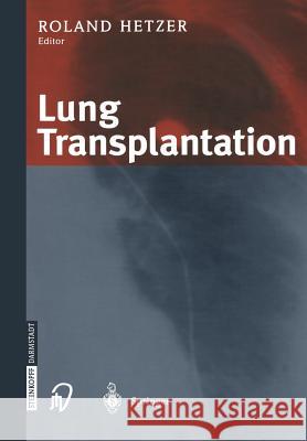 Lung Transplantation R. Hetzer 9783662046791 Steinkopff-Verlag Darmstadt