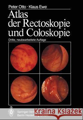 Atlas Der Rectoskopie Und Coloskopie Otto, P. 9783662058800 Springer