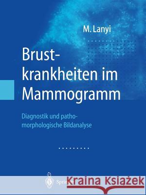 Brustkrankheiten Im Mammogramm: Diagnostik Und Pathomorphologische Bildanalyse Lanyi, Marton 9783662061787