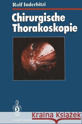 Chirurgische Thorakoskopie Rolf Gilbert Carl Inderbitzi U. Althaus C. Boutin 9783662062548 Springer