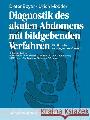 Diagnostik Des Akuten Abdomens Mit Bildgebenden Verfahren: Ein Klinisch-Radiologisches Konzept Beyer, Dieter 9783662065945 Springer