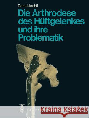 Die Arthrodese Des Hüftgelenkes Und Ihre Problematik Müller, M. E. 9783662066263 Springer