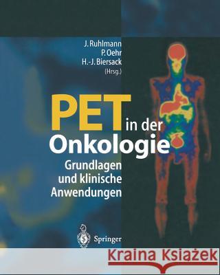 Pet in Der Onkologie: Grundlagen Und Klinische Anwendung Ruhlmann, Jürgen 9783662092439 Springer