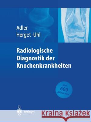 Radiologische Diagnostik Der Knochenkrankheiten Adler, Claus-Peter 9783662096611