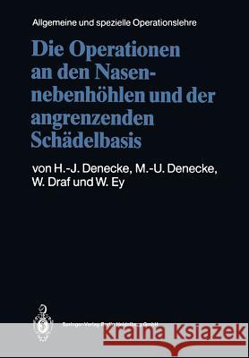 Die Operationen an Den Nasennebenhöhlen Und Der Angrenzenden Schädelbasis Denecke, Hans-Joachim 9783662115213 Springer