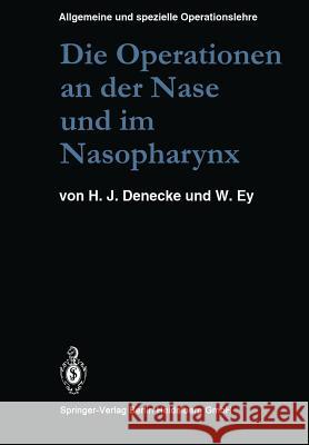 Die Operationen an Der Nase Und Im Nasopharynx: Mit Berücksichtigung Der Transsphenoidalen Operationen an Der Hypophyse Und Der Eingriffe Am Vegetativ Denecke, M. U. 9783662115237 Springer