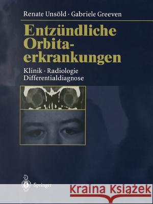 Entzündliche Orbitaerkrankungen: Klinik - Radiologie - Differentialdiagnose Unsöld, Renate 9783662116852 Springer