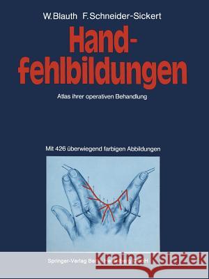 Handfehlbildungen: Atlas Ihrer Operativen Behandlung Blauth, W. 9783662119891 Springer