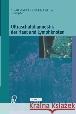 Ultraschalldiagnostik Der Haut Und Lymphknoten Klaus Garbe Andreas Blum 9783662132555 Steinkopff-Verlag Darmstadt